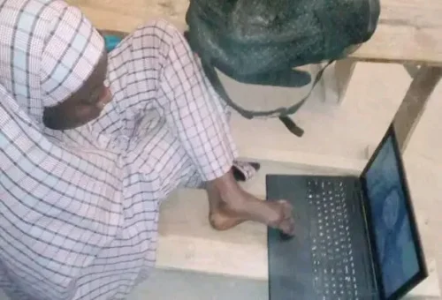 Limb Difference: Nigerian Student Overcomes Challenges To Attain University Education