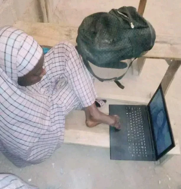Limb Difference: Nigerian Student Overcomes Challenges To Attain University Education