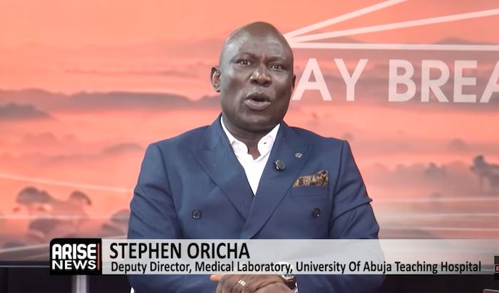 Nigeria Must Strengthen Ebola Preparedness Before An Outbreak – Arise News